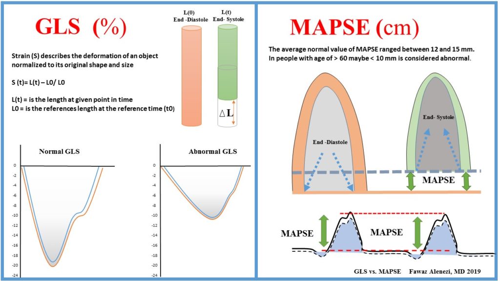 Cardiac Longitudinal Function: GLS vs. MAPSE