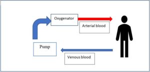 Figure 1: Simple schematic illustration of veno-arterial VA-ECMO utilized in EPCR.