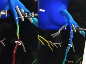 Innovations in 3-D and 4-D Technology in the Cath Lab