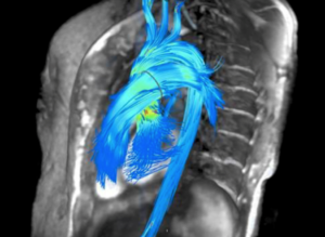 Innovations in 3-D and 4-D Technology in the Cath Lab