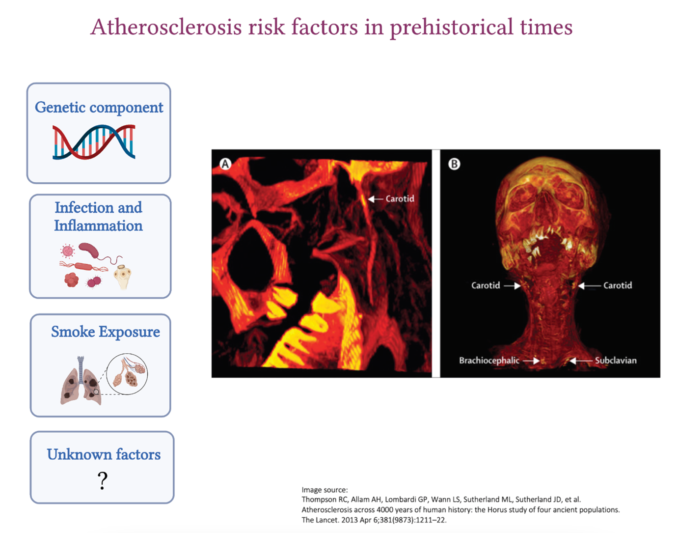 Atherosclerosis in Prehistorical Times