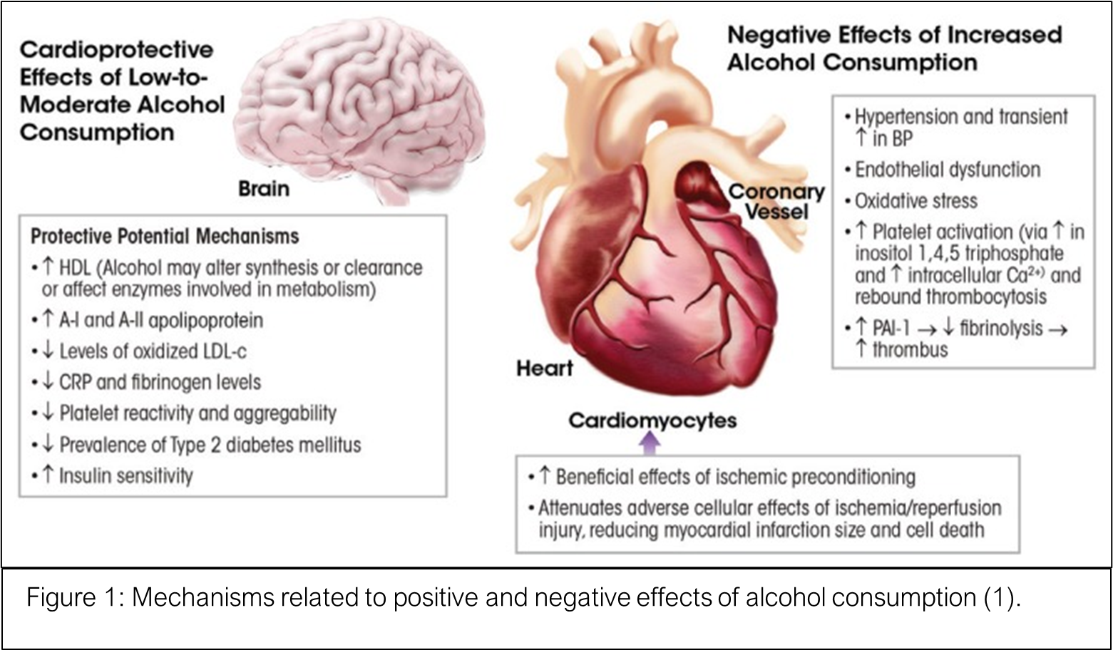 The controversy over alcohol consumption: Is it good or bad for your heart?